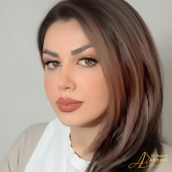 نمونه جراحی بینی دکتر حامد عباسی