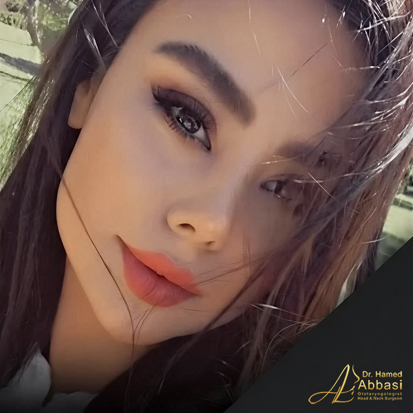 نمونه جراحی بینی دکتر حامد عباسی