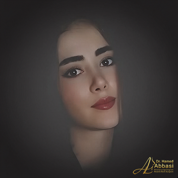 نمونه جراحی بینی دکتر حامد عباسی