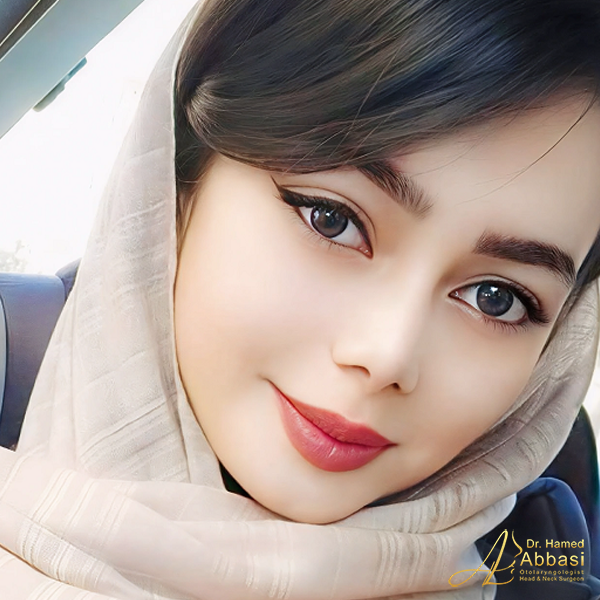 نمونه جراحی بینی دکتر حامد عباسی