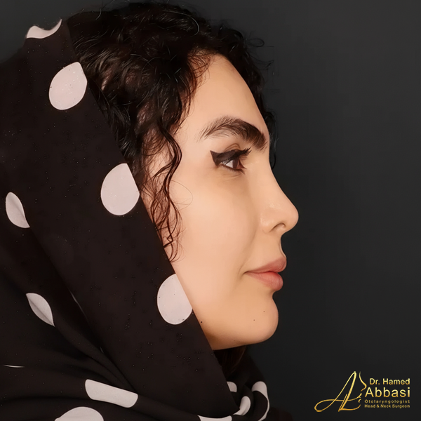 جراحی بینی دکتر حامد عباسی