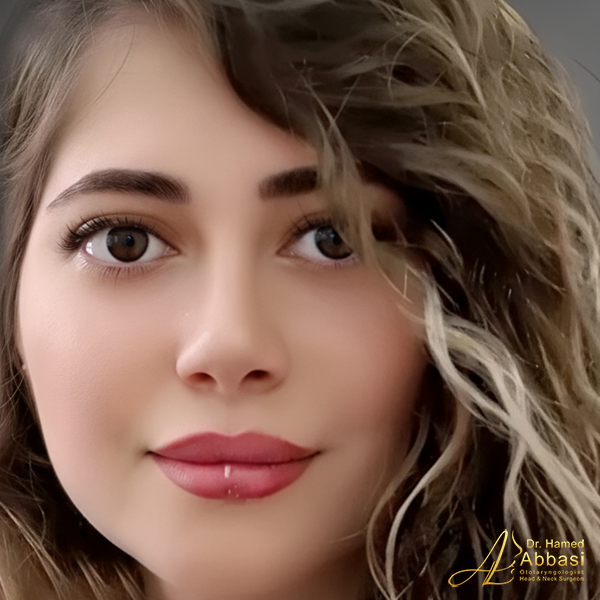 نمونه جراحی بینی دکتر حامد عباسی