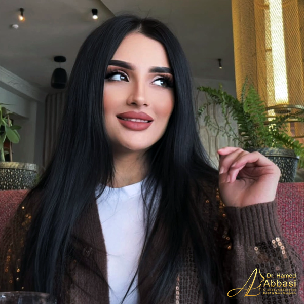 نمونه جراحی بینی دکتر حامد عباسی