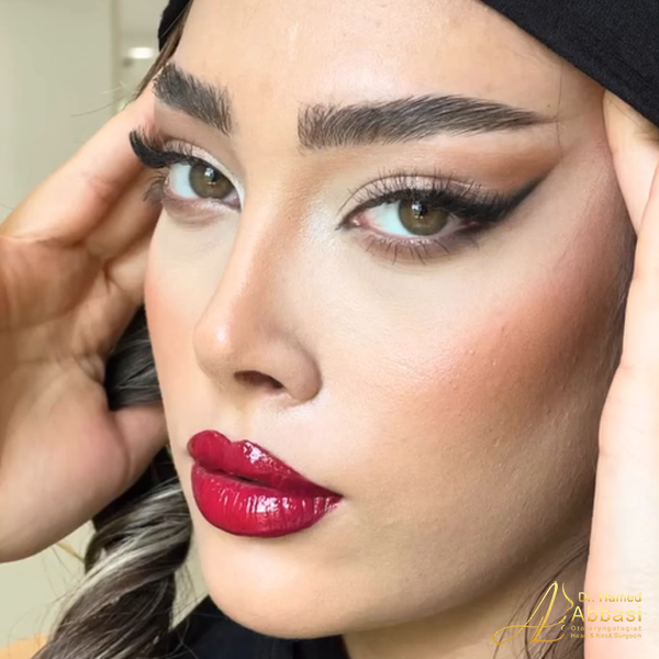 جراحی بینی دکتر حامد عباسی