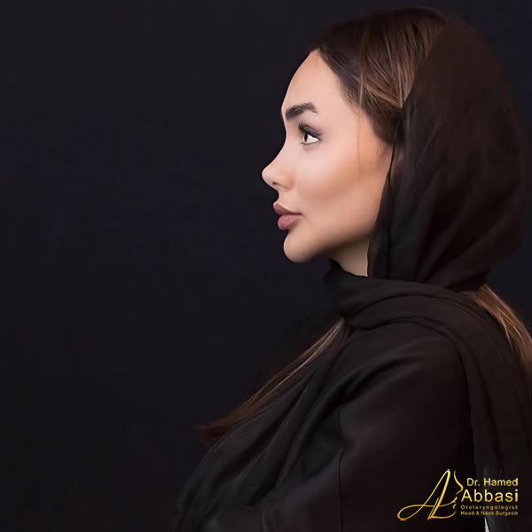 جراحی بینی دکتر حامد عباسی