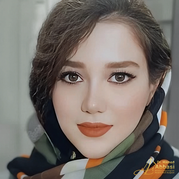 جراحی بینی دکتر حامد عباسی