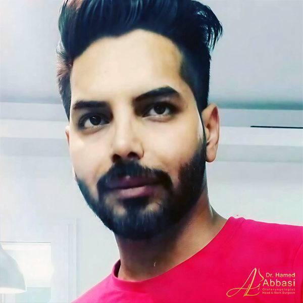 جراحی بینی دکتر حامد عباسی