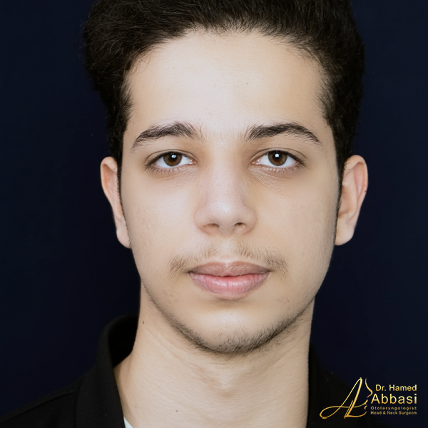 جراحی بینی دکتر حامد عباسی