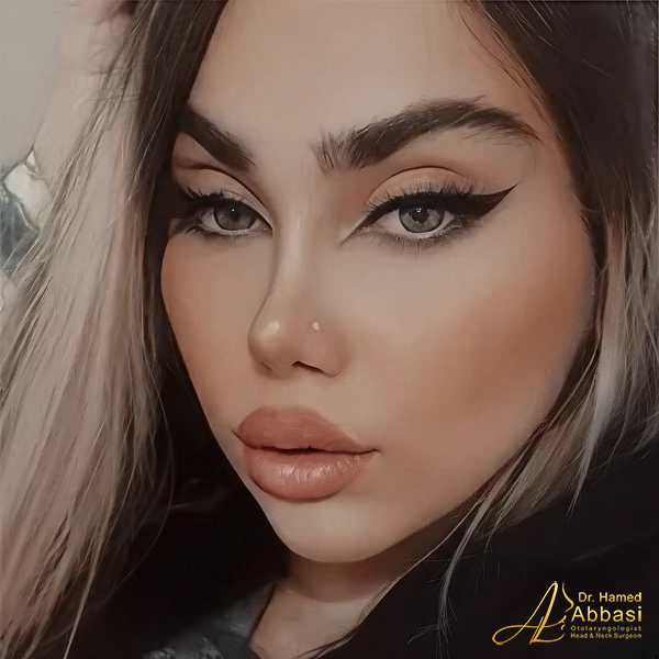 جراحی بینی دکتر حامد عباسی
