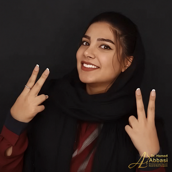 نمونه جراحی بینی دکتر حامد عباسی