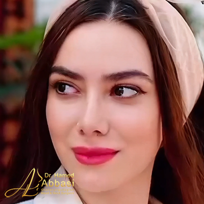 تصاویر عمل جراحی بینی دکتر عباسی