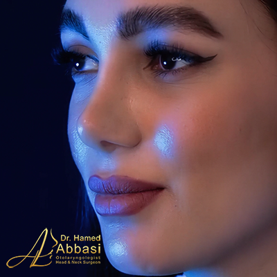 تصاویر عمل جراحی بینی دکتر عباسی