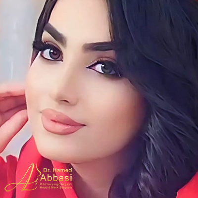 تصاویر عمل جراحی بینی دکتر عباسی