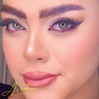 تصاویر عمل جراحی بینی دکتر عباسی