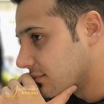 تصاویر عمل جراحی بینی دکتر عباسی