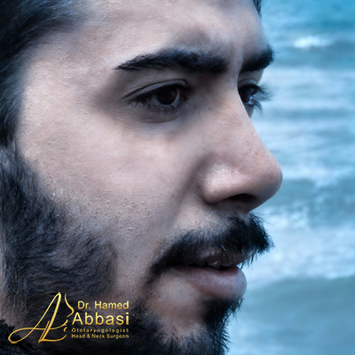 تصاویر عمل جراحی بینی دکتر عباسی