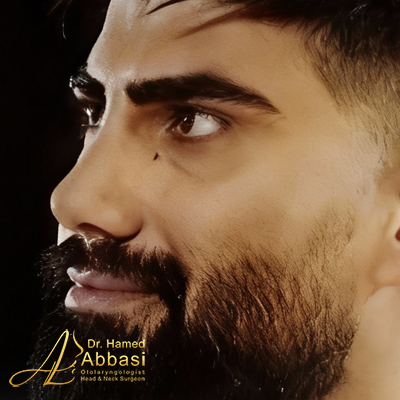 تصاویر عمل جراحی بینی دکتر عباسی