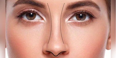 فرم بینی زیبا چه ویژگی‌هایی دارد؟ نکات مهم در بررسی فرم بینی