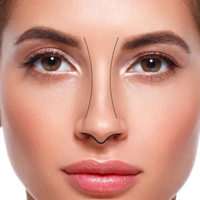 فرم بینی زیبا چه ویژگی‌هایی دارد؟ نکات مهم در بررسی فرم بینی