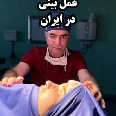 جدیدترین تکنیک‌های عمل بینی فانتزی در ایران