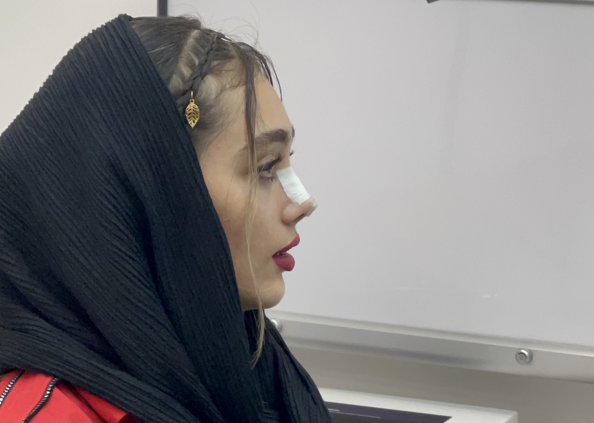 چرا مراقبت بعد از برداشتن گچ مهم است؟