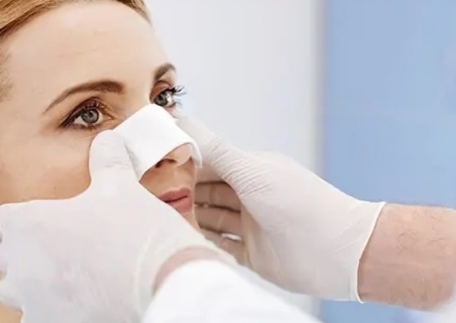 تاثیر عمل بینی بر گونه ها