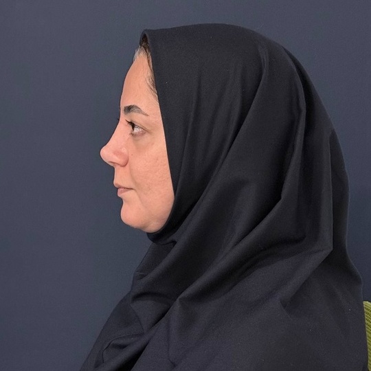 نوع بینی و محدودیت های طبیعی آن