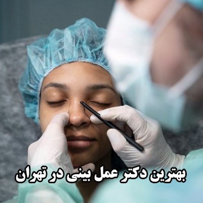 بهترین دکتر عمل بینی در تهران را چطور پیدا کنیم؟