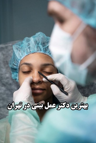 بهترین دکتر عمل بینی در تهران را چطور پیدا کنیم؟