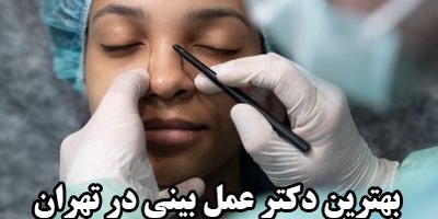 بهترین دکتر عمل بینی در تهران را چطور پیدا کنیم؟