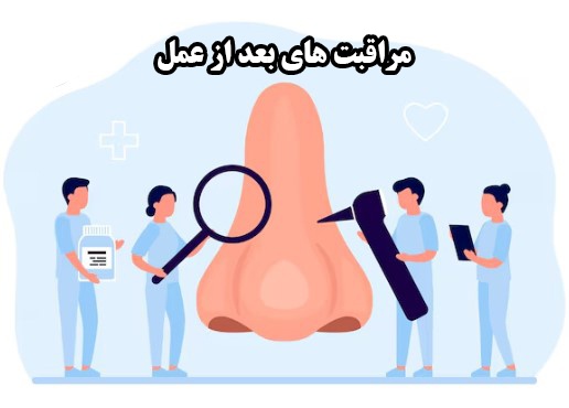 مراقبت‌های 24 ساعت اول بعد از عمل بینی