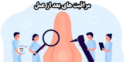 مراقبت‌های 24 ساعت اول بعد از عمل بینی