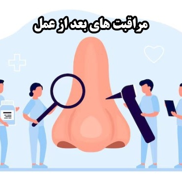 مراقبت‌های 24 ساعت اول بعد از عمل بینی