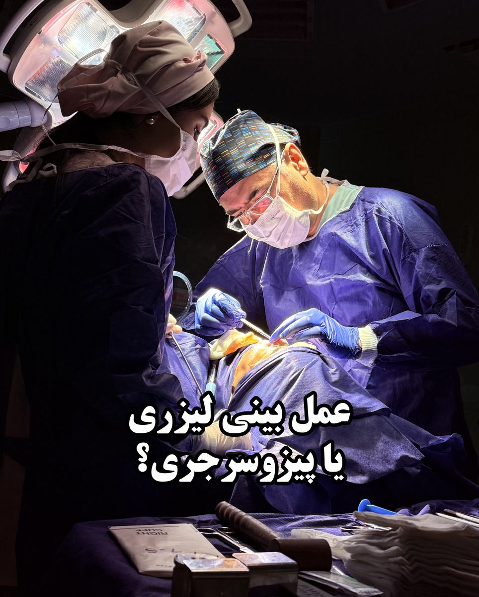 همه چیز درباره عمل بینی لیزری ؛ آیا لیزر واقعا جایگزین جراحی شده؟