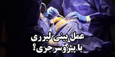 همه چیز درباره عمل بینی لیزری ؛ آیا لیزر واقعا جایگزین جراحی شده؟