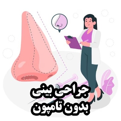 جراحی بینی بدون تامپون چگونه انجام می‌شود؟