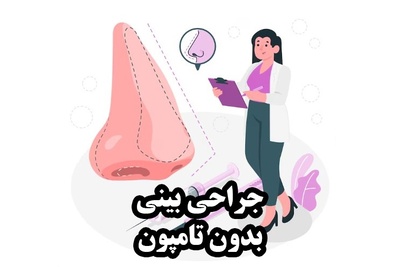جراحی بینی بدون تامپون چگونه انجام می‌شود؟