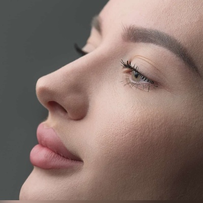 پل بینی چیست؟ از انواع پل بینی تا روش‌های اصلاح و ترمیم