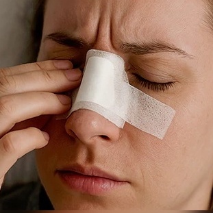 مشکل تنفس بعد از جراحی بینی؛ چرا بینی می‌گیرد و چگونه آن را درمان کنیم؟