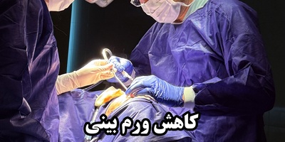 روش‌های کاهش ورم بعد از عمل بینی