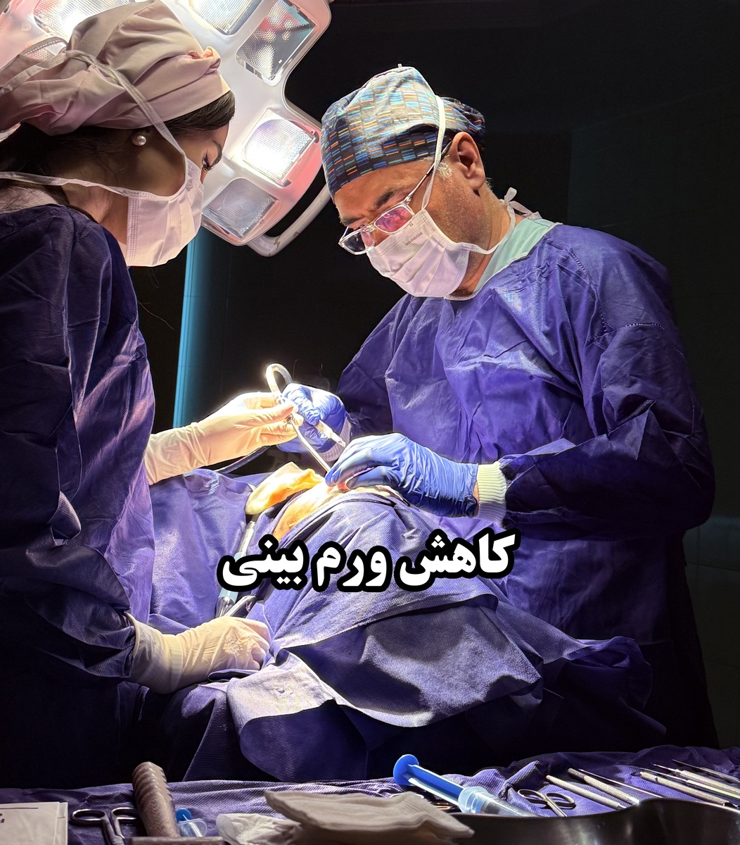 روش‌های کاهش ورم بعد از عمل بینی