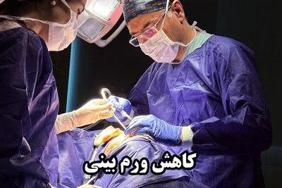 روش‌های کاهش ورم بعد از عمل بینی