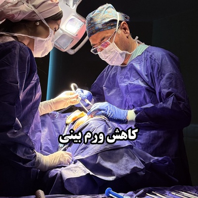 روش‌های کاهش ورم بعد از عمل بینی