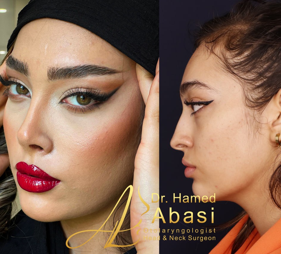 عمل ترمیمی بینی