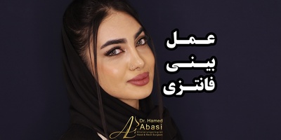 عمل بینی فانتزی ؛ مدل‌های پرطرفدار و اصول انتخاب