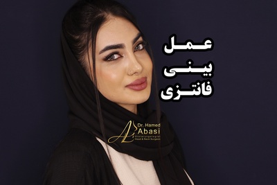 عمل بینی فانتزی ؛ مدل‌های پرطرفدار و اصول انتخاب