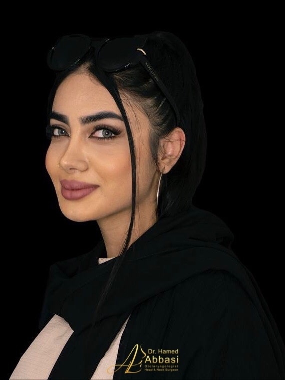 عمل بینی فانتزی