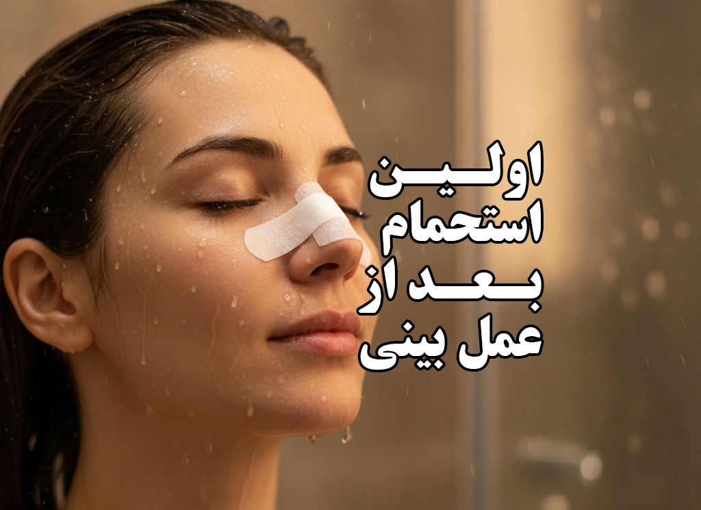 چند روز بعد از عمل بینی حمام کنیم ؟ نکات مهمی که باید رعایت شود