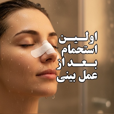 چند روز بعد از عمل بینی حمام کنیم ؟ نکات مهمی که باید رعایت شود
