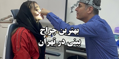 ویژگی‌های بهترین جراح بینی در تهران از نگاه بیماران